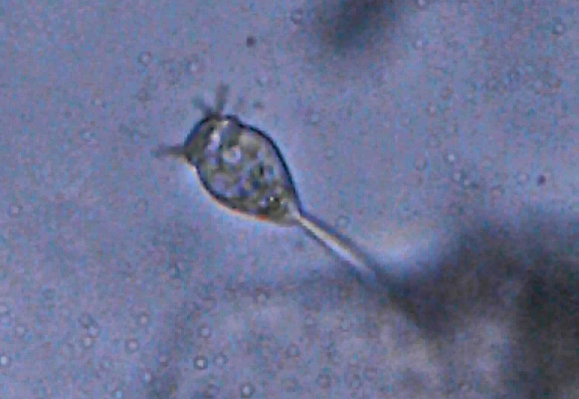 Il mondo microscopico in una pozza di citt